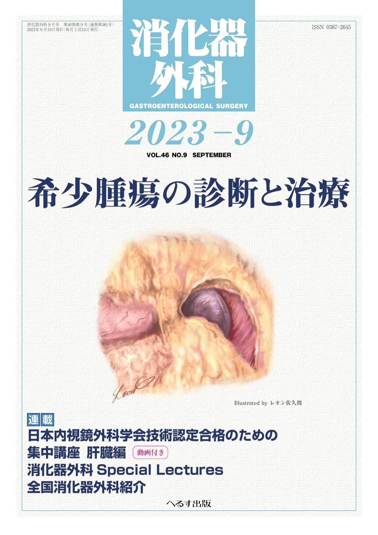 消化器外科 : 特集：希少腫瘍の診断と治療 2023年9月号（46巻9号）