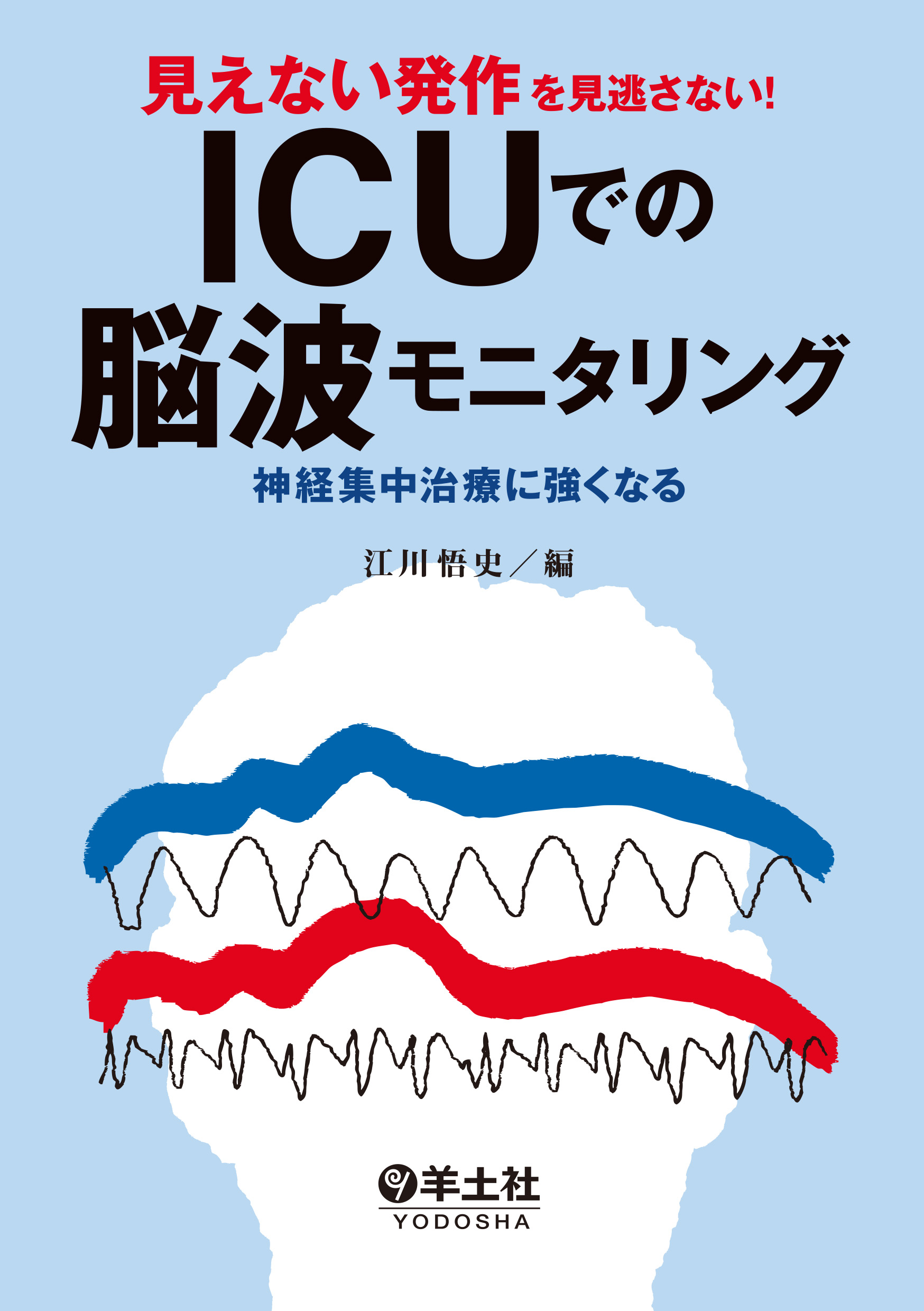 見えない発作を見逃さない！ICUでの脳波モニタリング : 神経集中