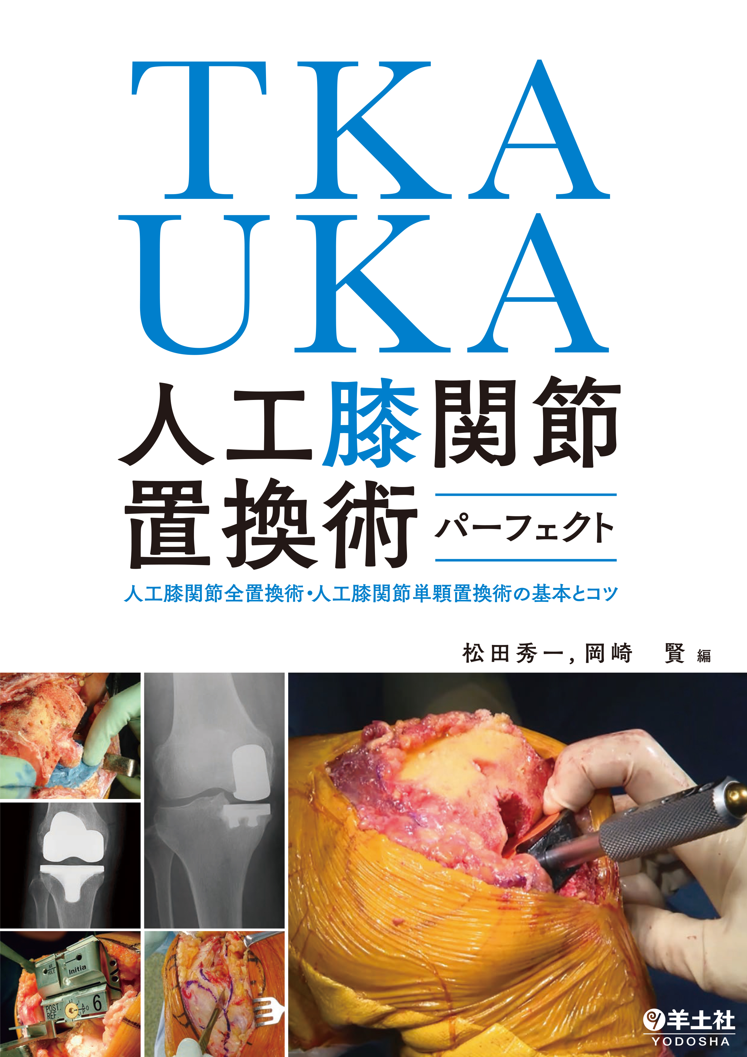 TKA・UKA 人工膝関節置換術パーフェクト