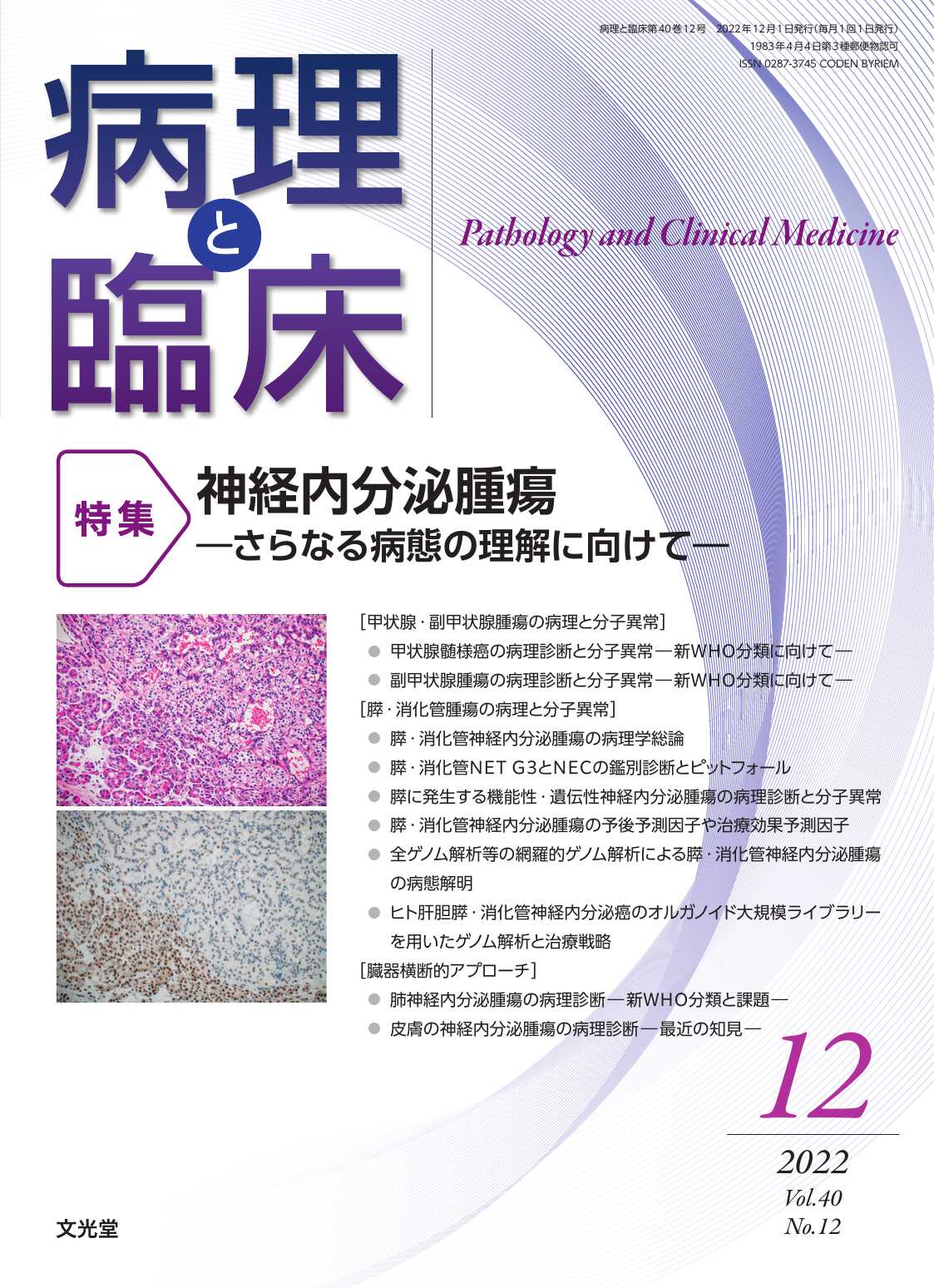 病理と臨床 : 特集 神経内分泌腫瘍―さらなる病態の理解に向け