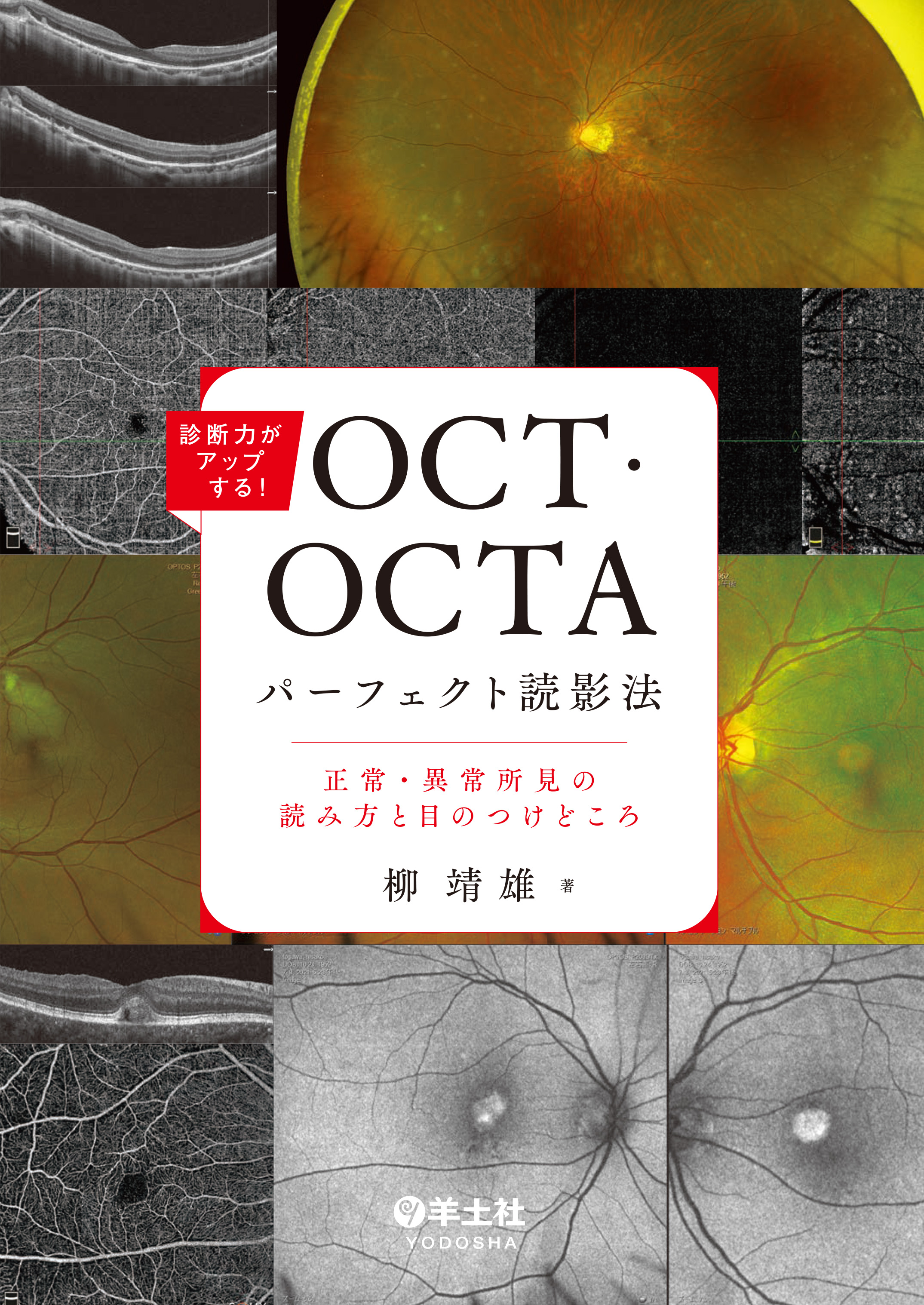 診断力がアップする!OCT・OCTAパーフェクト読影法 正常・異常所見の